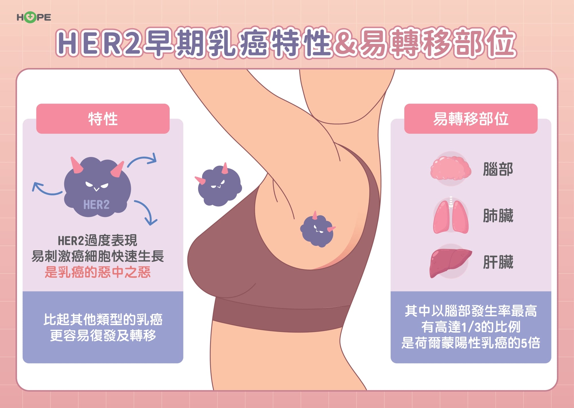 標靶藥物翻轉命運！HER2陽性早期乳癌積極治療抗復發　有機會痊癒