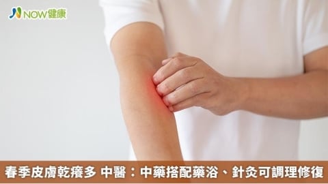 春季皮膚乾癢多 中醫：中藥搭配藥浴、針灸可調理修復