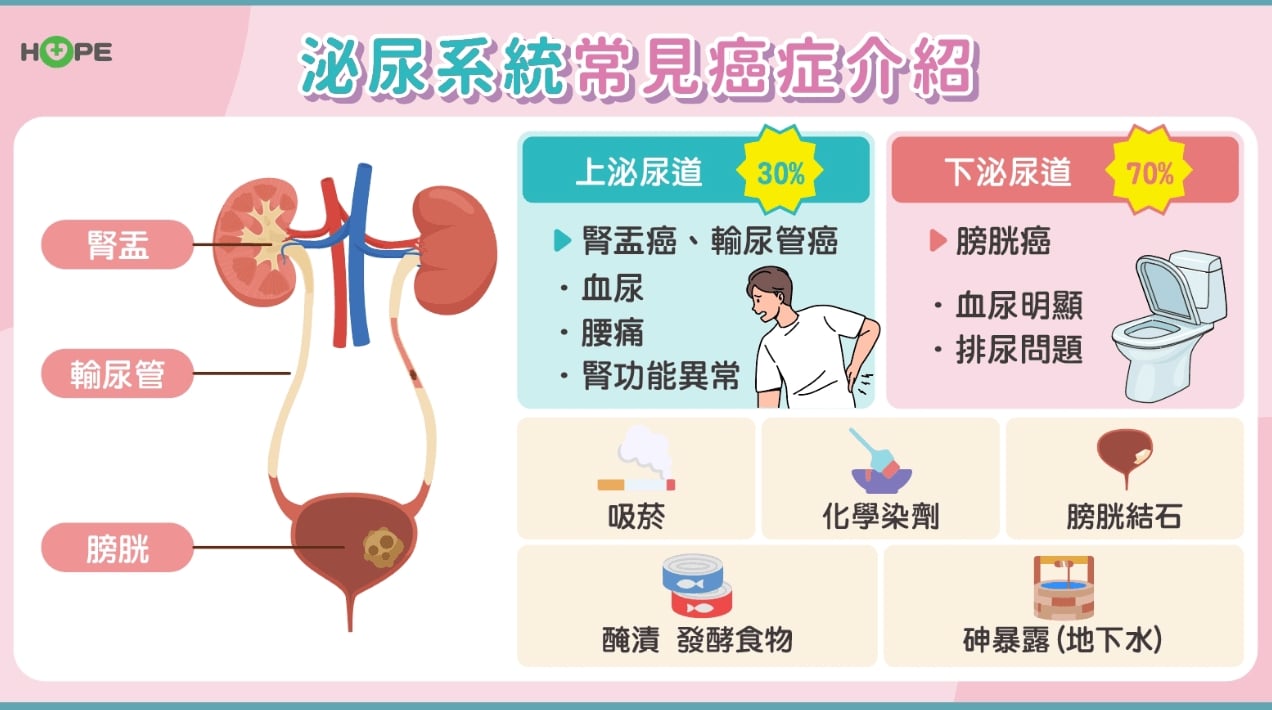 膀胱癌最新治療！晚期轉移也能拒絕高死亡率