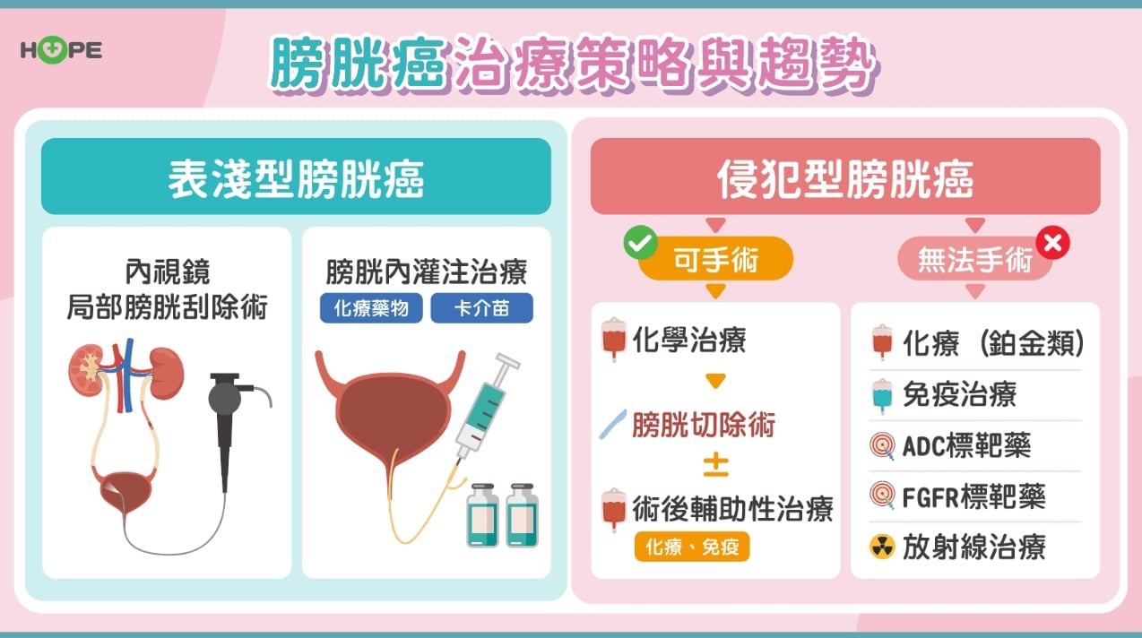 膀胱癌最新治療！晚期轉移也能拒絕高死亡率
