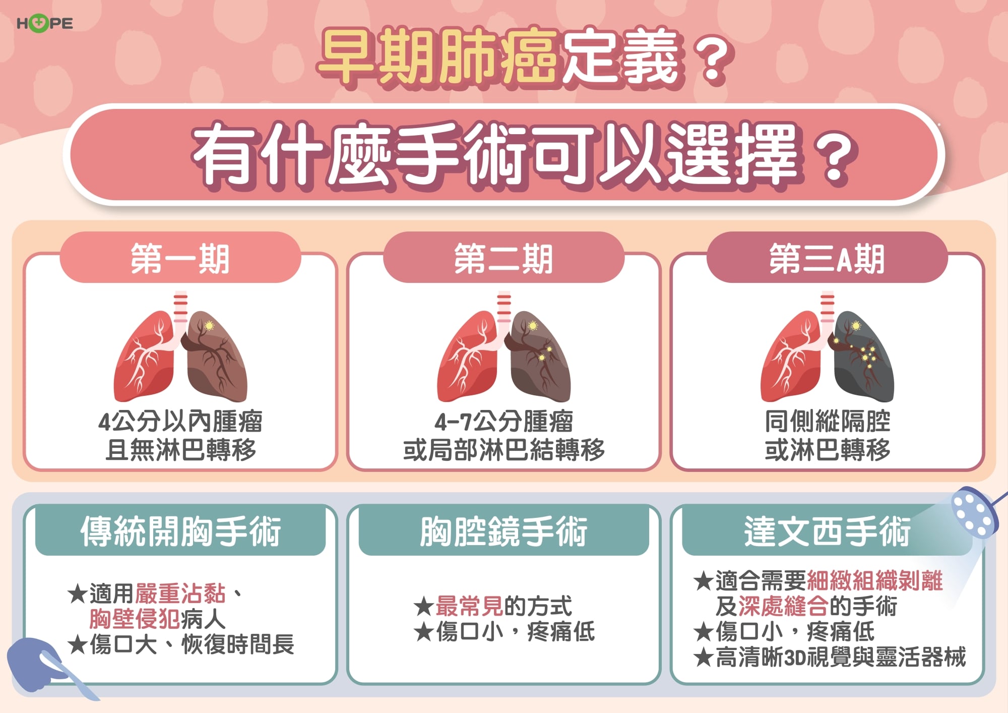 早期肺癌莫驚慌！標靶治療來助攻