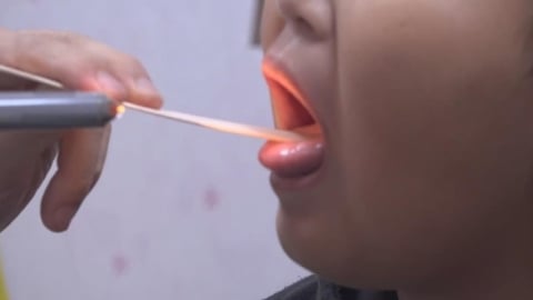 診間「BBB」響不停！醫示警「這疾病」傳染力強：「腳痛、腹瀉」要警覺