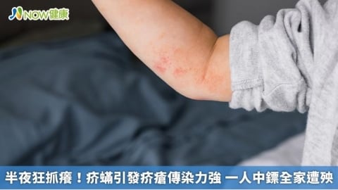 半夜狂抓癢！疥蟎引發疥瘡傳染力強 一人中鏢全家遭殃