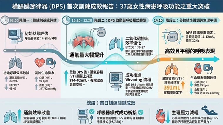 三總跨國合作！腦梗婦植入橫膈膜節律器 重新自主呼吸