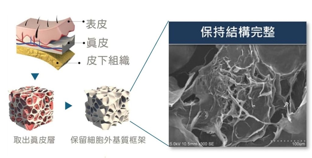 異體真皮粉退出台灣！「再生真皮粉」接棒掀微整新風潮