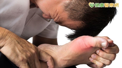 雞蛋大般的痛風石破裂有如爆漿！醫師警告：長年忽視恐釀截肢悲劇