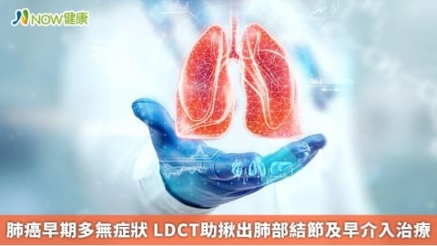 肺癌早期多無症狀 LDCT助揪出肺部結節及早介入治療