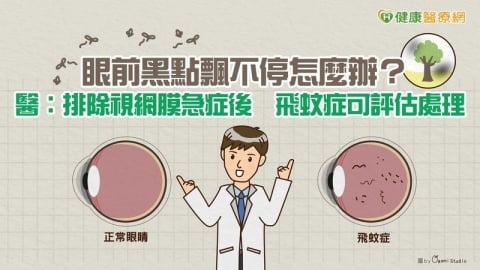 眼前黑點飄不停怎麼辦？醫：排除視網膜急症後　飛蚊症可評估處理