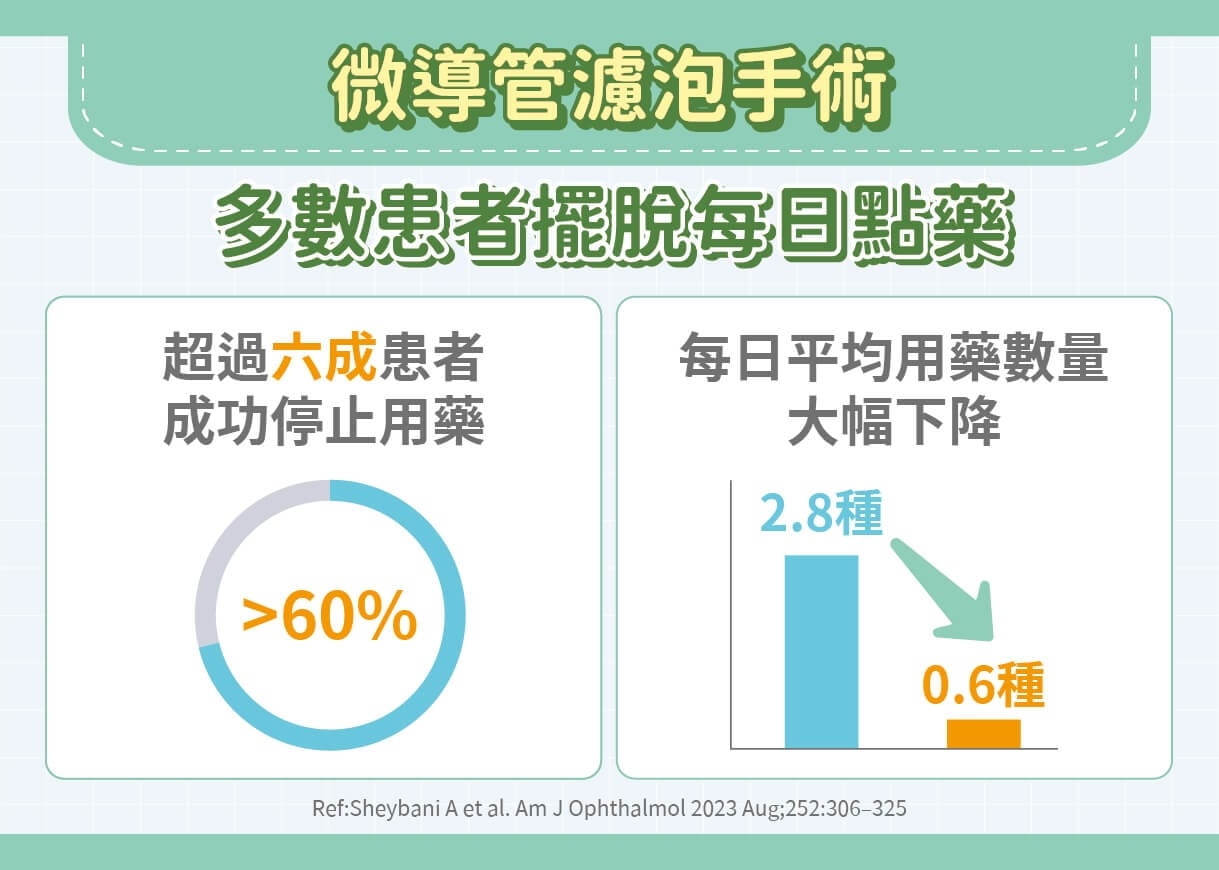青光眼治療不只靠點藥！微創導管濾泡手術助減藥：6成患者一年後可望不再用藥