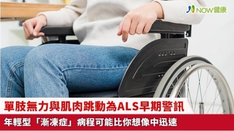 單肢無力與肌肉跳動為ALS早期警訊 年輕型「漸凍症」病程可能比你想像中迅速
