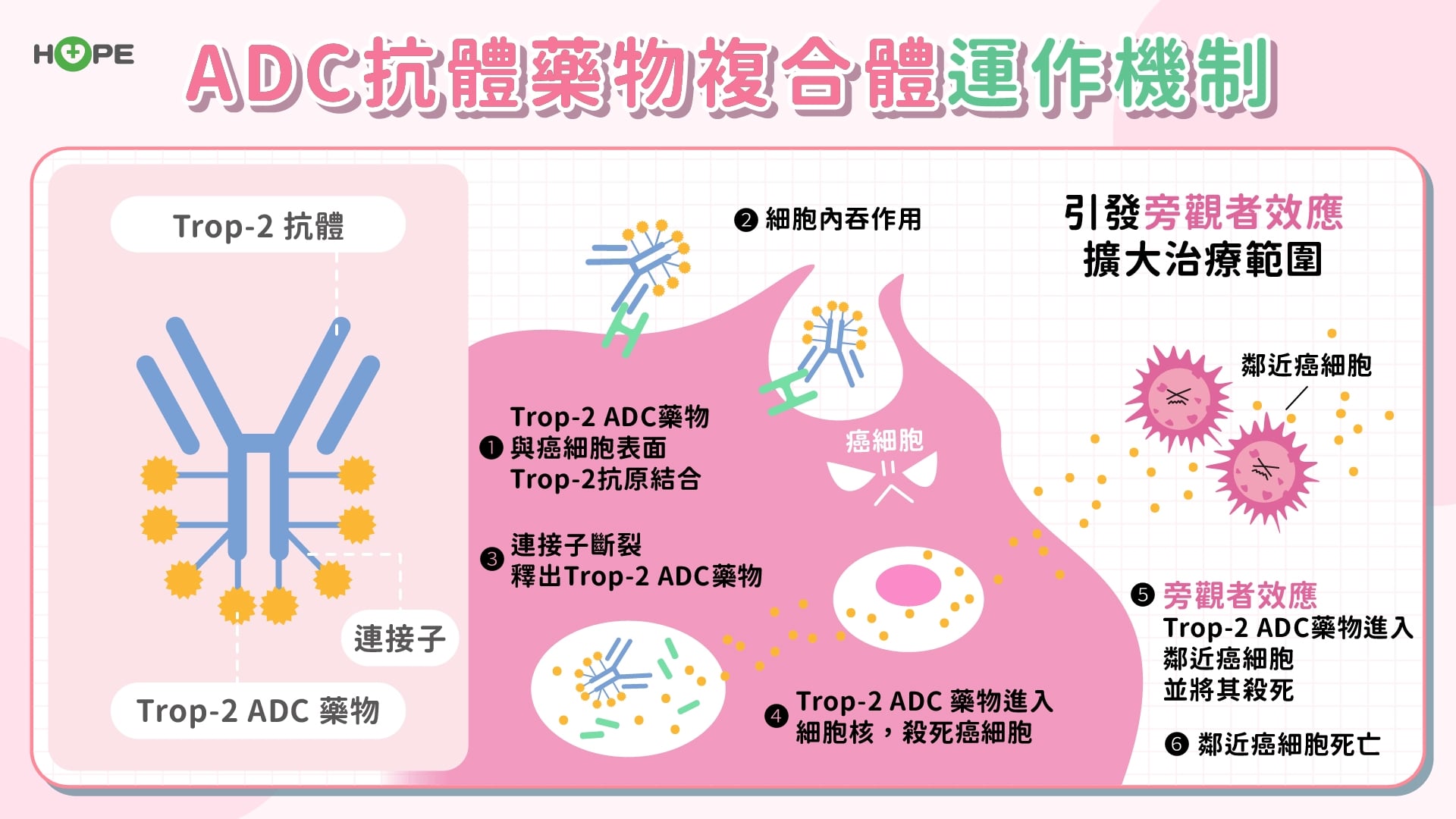 擊碎「最難踢鐵板」!ADC 藥物木馬屠城 轉移性乳癌迎來生存曙光