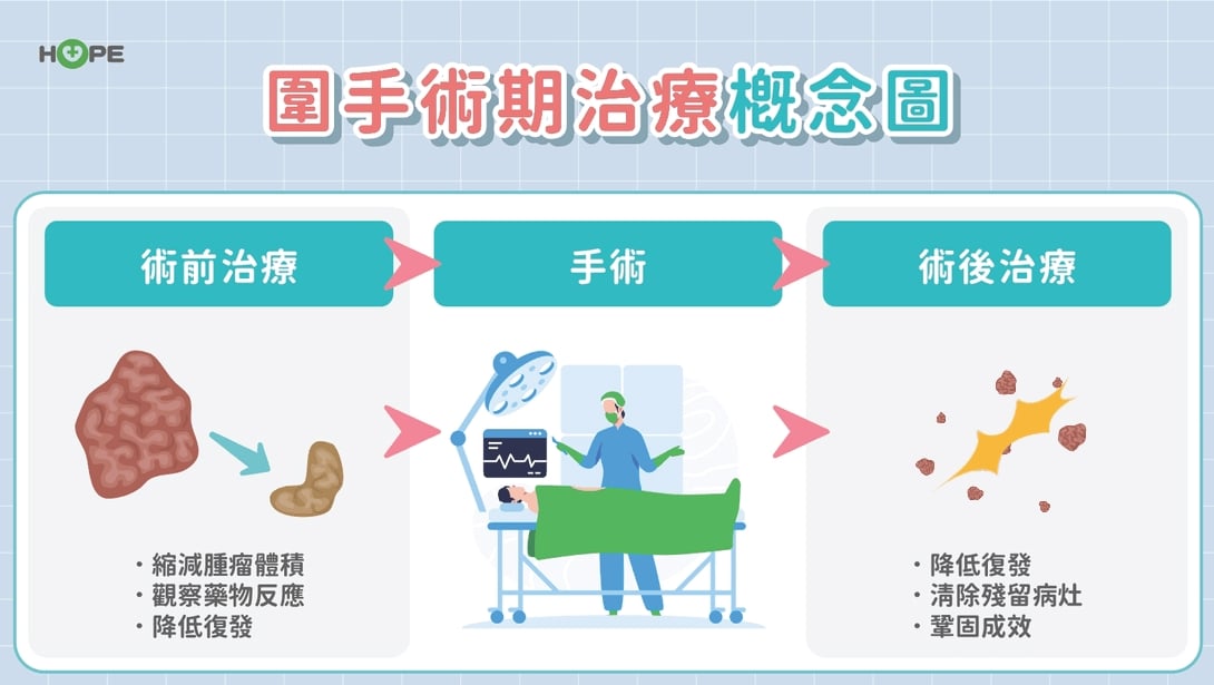 胃癌一定要全切?「圍手術期治療」新趨勢:提升存活率 更有機會保住胃功能