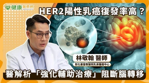 HER2陽性乳癌易腦轉移 高風險群可依情況進行「多一年治療防線」