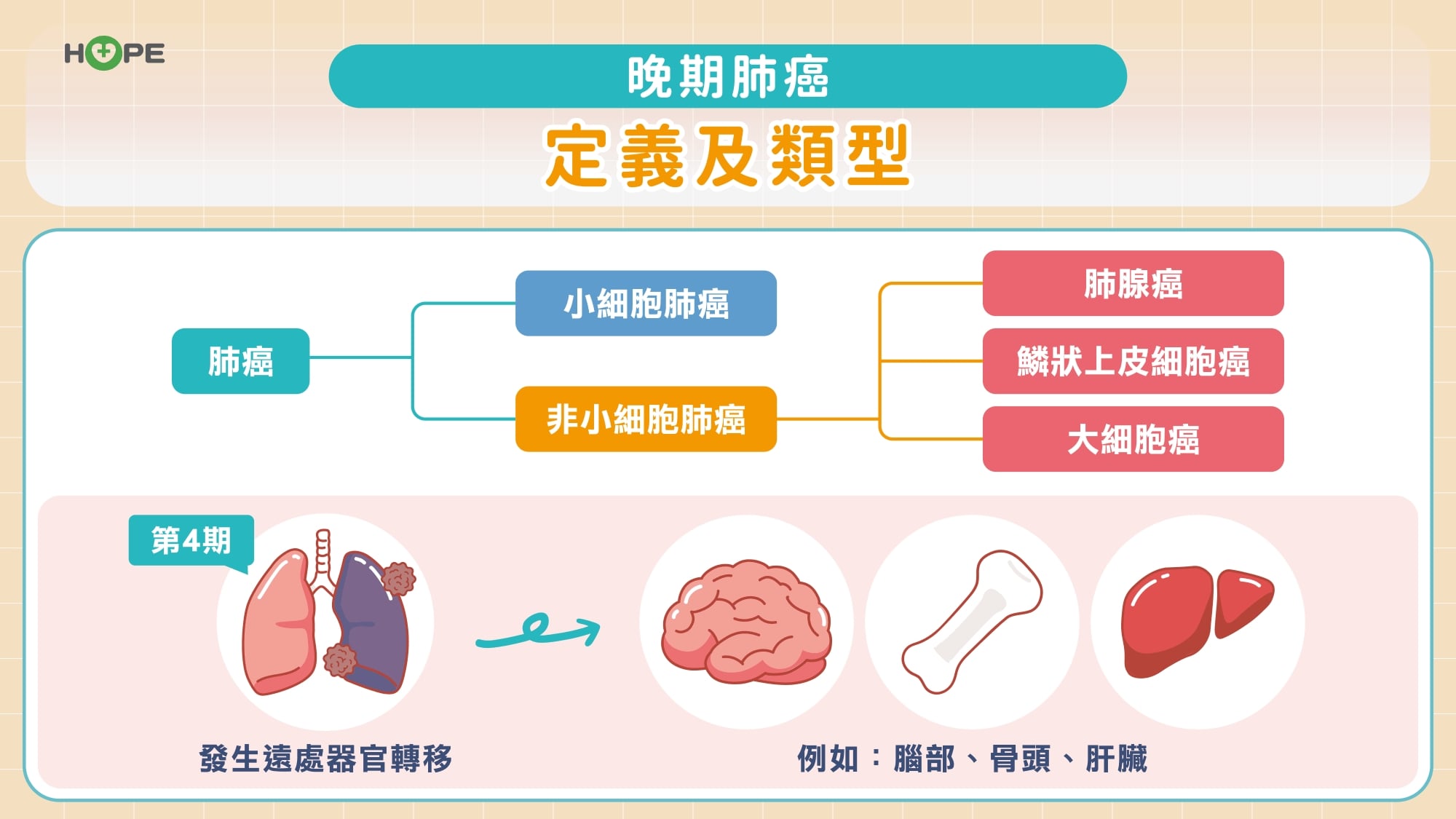 健保助攻晚期肺癌治療 第一線使用第三代標靶兼顧療效與生活品質
