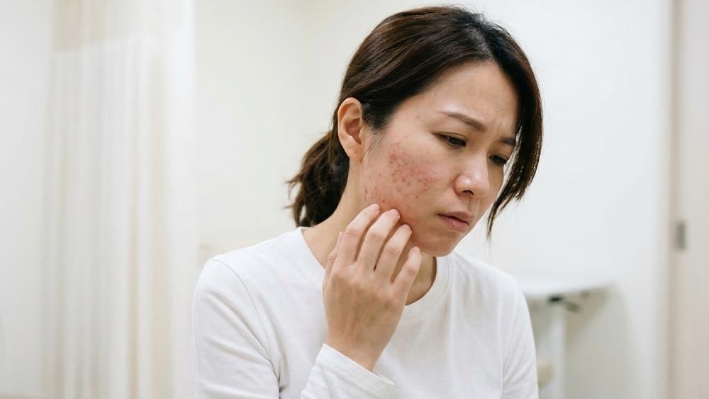 為什麼皮膚摸起來一顆一顆粗粗的？醫師解析「角質堆積型粗糙肌」