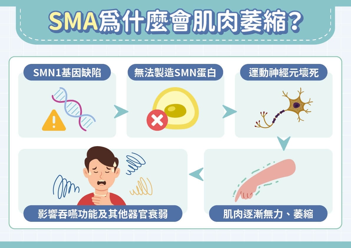 從無藥可醫到人生翻轉！SMA治療新時代：不只是活著，而是活得更好