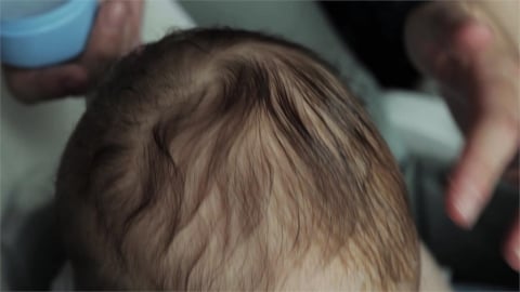 我的孩子掉頭髮正常嗎？家長必備初步判斷指南一次看　醫揭照護「3關鍵」