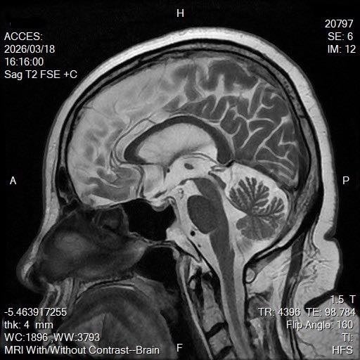 陳文茜抗癌多年「突爆MRI沒癌細胞」!遭酸「怎還沒S」本人親回嗆6字了