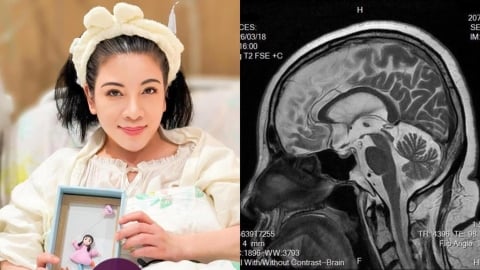 陳文茜抗癌多年「突爆MRI沒癌細胞」！遭酸「怎還沒S」本人親回嗆6字了