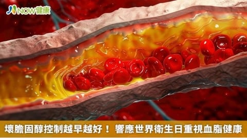 壞膽固醇控制越早越好！ 響應世界衛生日重視血脂健康