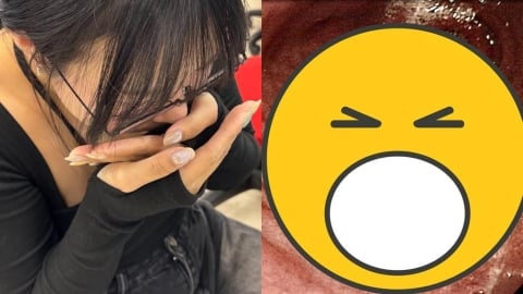 他突吐血照胃鏡驚見「一顆顆鵝卵石」！竟是感染「一級致癌物」最嚴重下場曝光