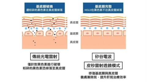 肝斑照護觀察：掃黑、修復與日常保養方式的應用