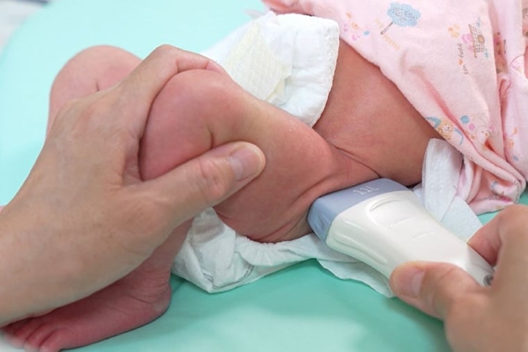 幼兒髖關節異常及早發現！避免長短腳 6個月大是關鍵