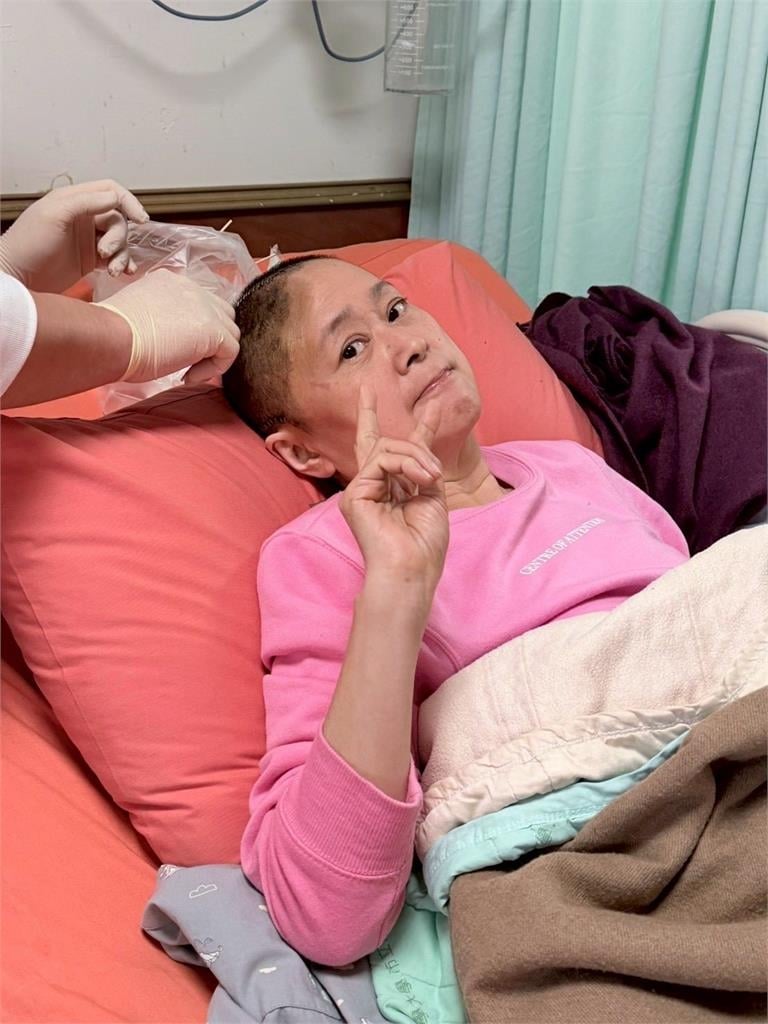 王月倒地撞頭急救「頭蓋骨1片遭摘」！最新近況曝光…醫揭搶命內幕：豆腐放硬盒子