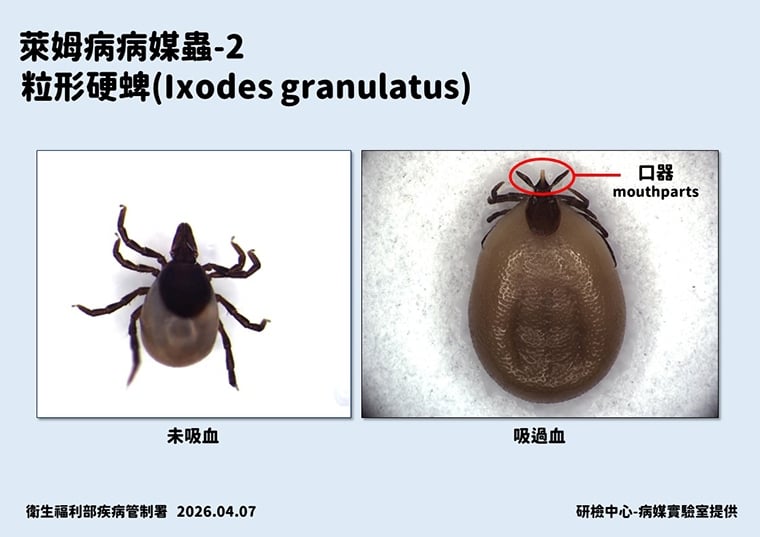 今年首例境外移入萊姆病！ 6旬女性自瑞典返台後發病