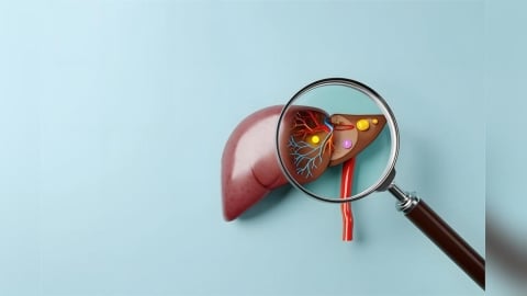 脂肪肝可以好嗎？營養師揭「8大類」護肝食物、「5招」遠離脂肪肝