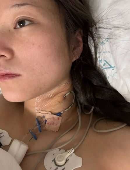 白姓女子2025年4月乘坐張姓男友駕駛的車輛時，發生車禍導致截癱。（圖／翻攝自微博）