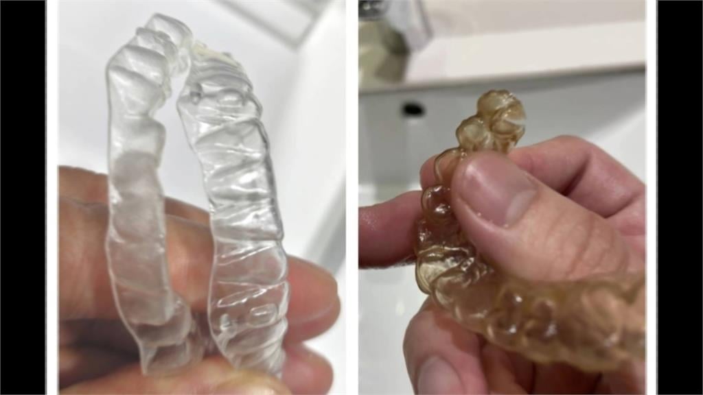 歐耐恩隱形牙套爭議延燒！　創辦人上火線說明遭火爆踢館