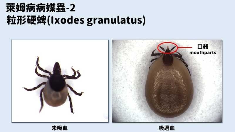 不治療恐延續數年！6旬婦紅斑和血尿上身　疾管署揭萊姆病預防措施