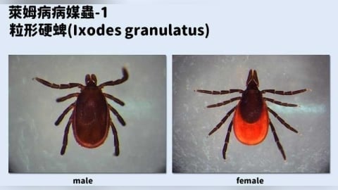 不治療恐延續數年！6旬婦紅斑和血尿上身　疾管署揭萊姆病預防措施