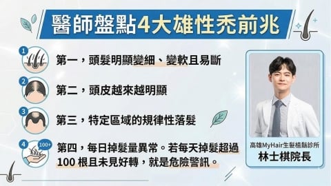 爸媽沒有禿頭我卻出現落髮？醫師解析從遺傳觀點認識雄性禿的常見表現
