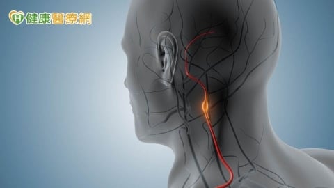 常頭暈又單側手腳發麻！醫警示：頸動脈狹窄恐釀中風風險