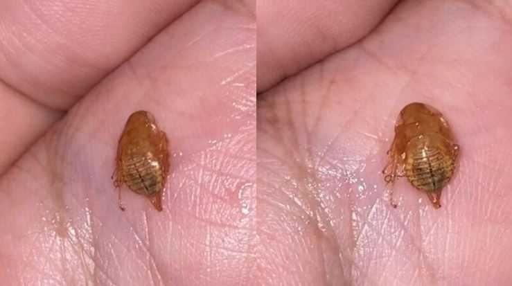 男子連續3天感到喉嚨不適,竟從口中咳出1隻不明生物。(圖/翻攝自Khaosod)