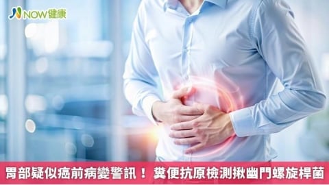 胃部疑似癌前病變警訊！ 糞便抗原檢測揪幽門螺旋桿菌