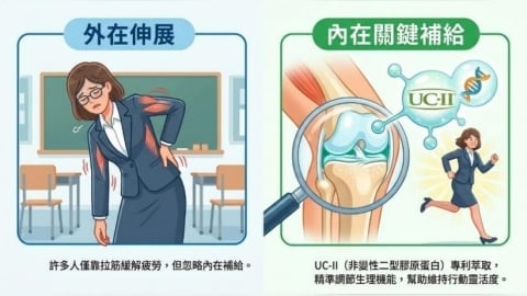 久站族日常保養觀點：認識UC-II等營養成分與行動靈活度的關聯