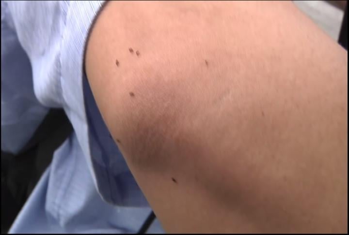 「這一縣市」黑蚊子多啊！ 公所熱點噴藥除小黑蚊大作戰