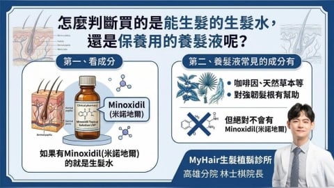 你選對了嗎？醫師教你認識生髮水與養髮液差異：從成分了解產品分類