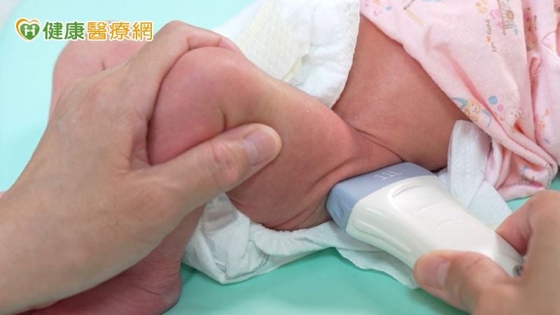 「怎麼抱」攸關寶寶髖關節發育是否正常　醫籲：六個月是治療黃金期