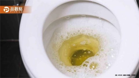 26歲女「泡泡尿」拖半年！腎功能暴跌剩10%緊急洗腎
