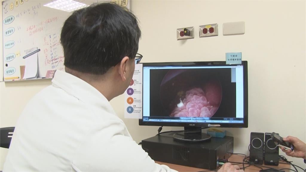 郭智輝罹癌震驚各界！醫示警「隱形癌王」四大症狀：年增逾2千人