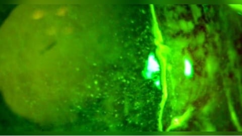 騎車遭蚊蟲飛入眼！男直覺「1動作」慘了　角膜差點爛穿險失明