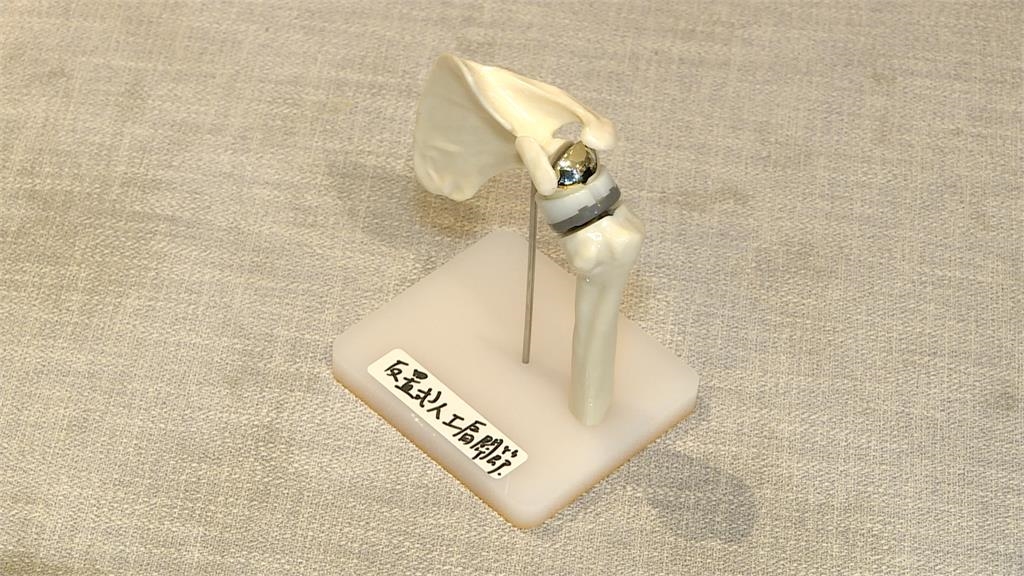 70歲開球投出人生新高度! 肩關節重建找回行動力