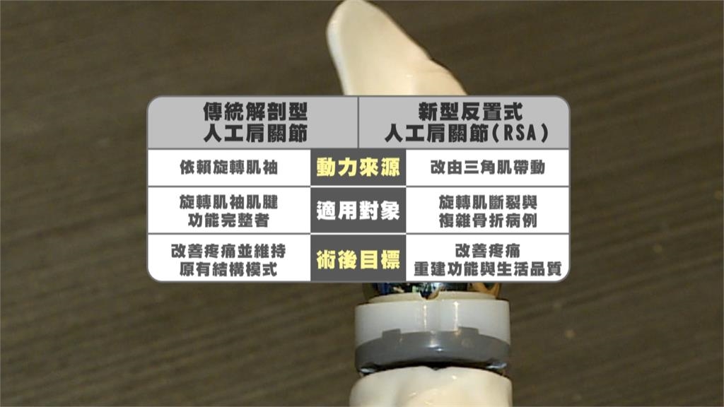 70歲開球投出人生新高度! 肩關節重建找回行動力