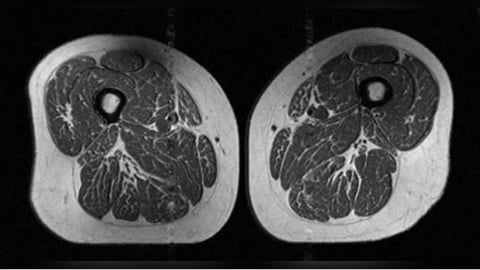 大腿肌肉變「A5和牛」！　研究：小心吃太多超加工食品