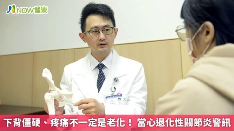 下背僵硬、疼痛不一定是老化！ 當心退化性關節炎警訊