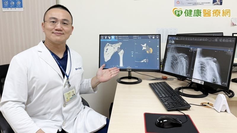 肩膀痛到梳頭都有困難　反式人工肩關節置換輔以3D術前模擬精準掌握角度